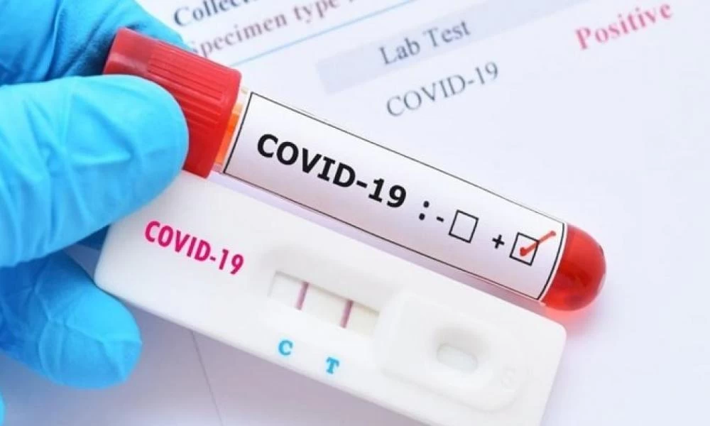Σχέδιο για χιλιάδες ελέγχους rapid test καθημερινά